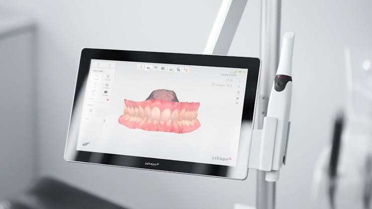 Escáner intraoral